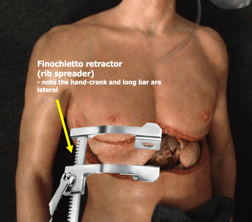 High Acuity Low Occurrence (HALO) Emergency Procedures