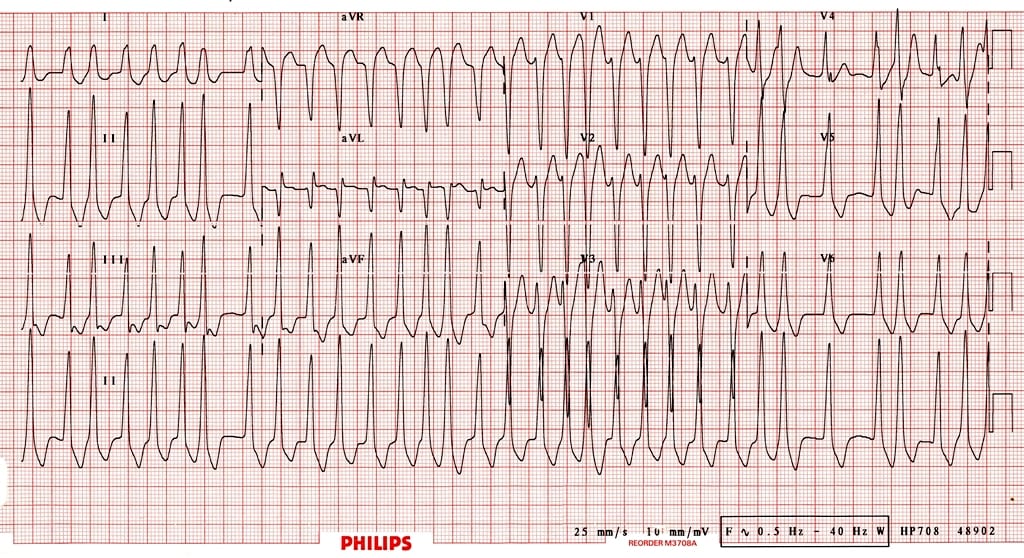 ECG Course